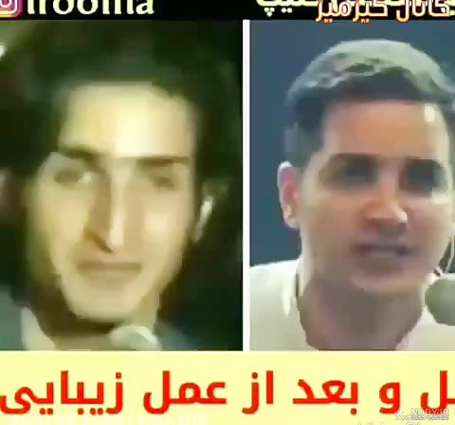 عکس محسن یگانه قبل از عمل بینی