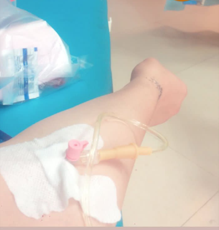 عکس وصل سرم به دست عکس وصل سرم به دست