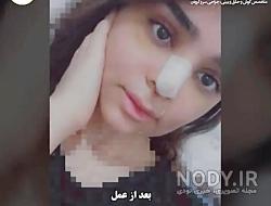 لاغری هانده ارچل لاغری هانده ارچل