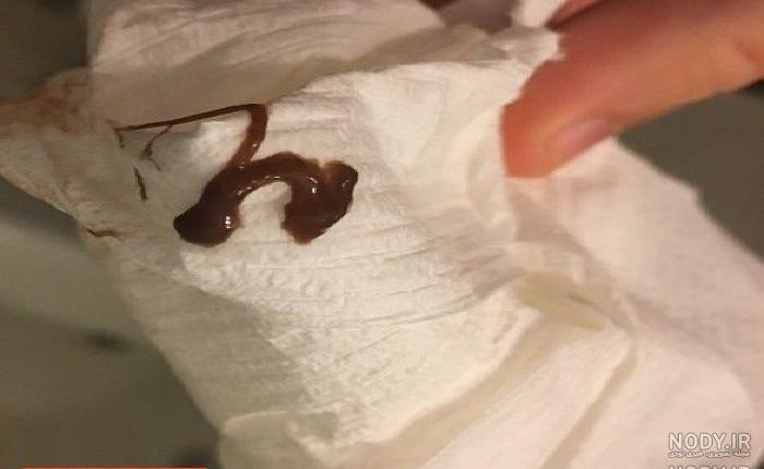 لکه بینی بارداری چه رنگی است نی نی سایت