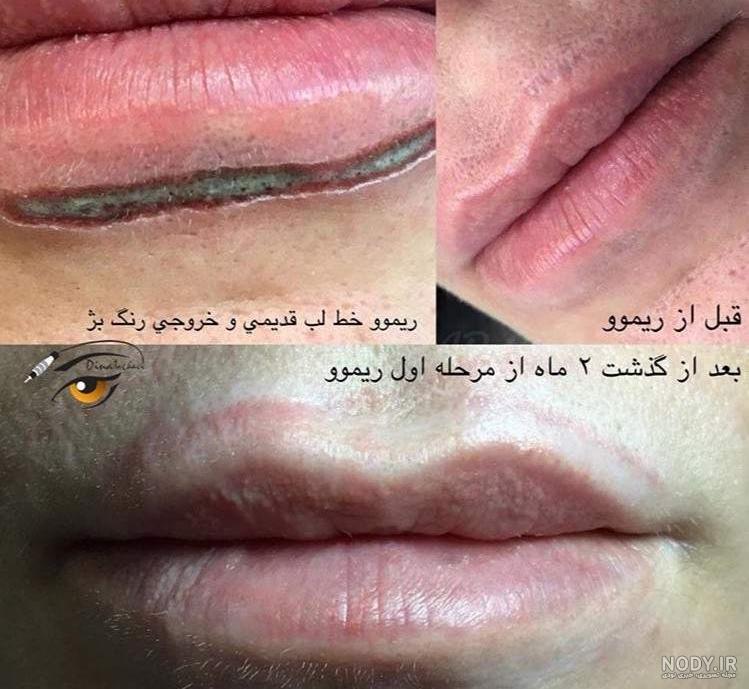 عکس انواع تاتو خط لب عکس انواع تاتو خط لب