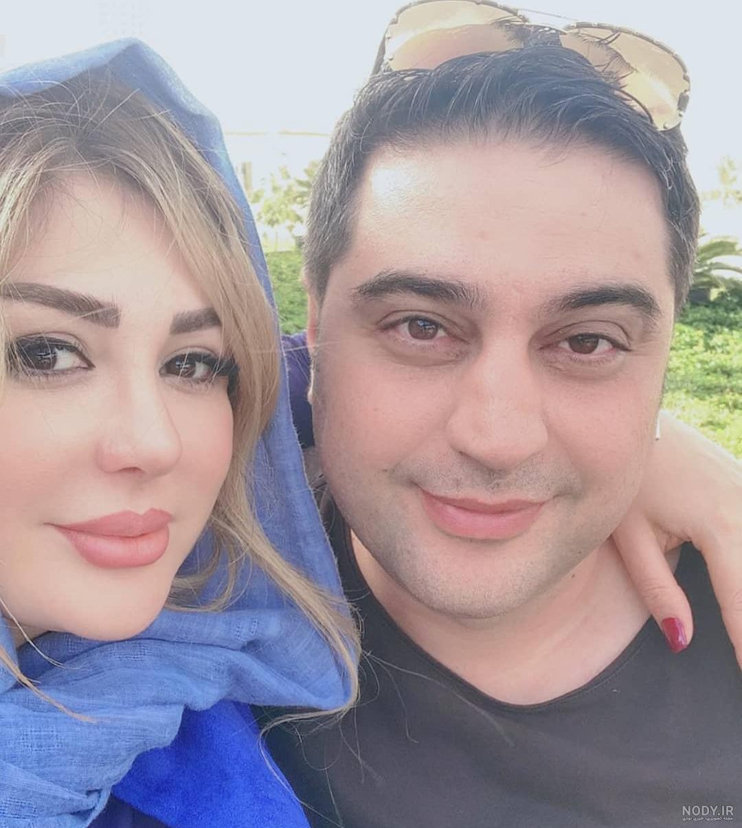 اسم دکتر عمل دوم بینی نیوشا ضیغمی