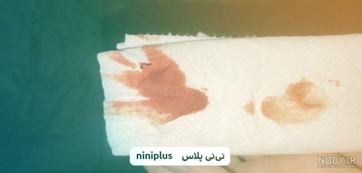 تصویر لکه بینی اوایل بارداری تصویر لکه بینی اوایل بارداری