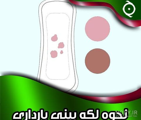 لکه بینی بارداری چه رنگی است لکه بینی بارداری چه رنگی است