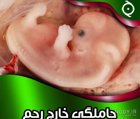 لکه بینی در اوایل بارداری چند روز طول میکشد لکه بینی در اوایل بارداری چند روز طول میکشد