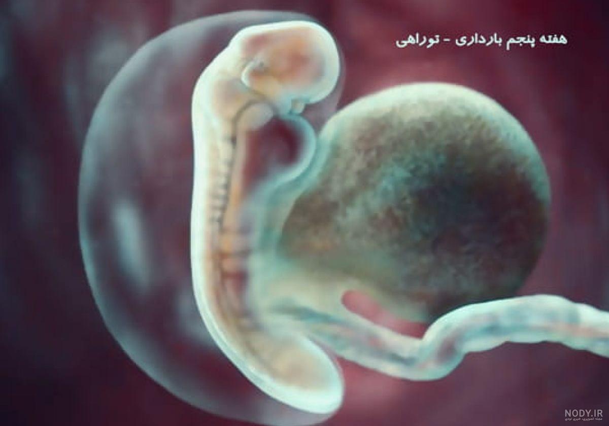 لکه بینی در بارداری نشانه پسر لکه بینی در بارداری نشانه پسر