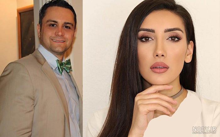 عکس صدف بیوتی قبل از عمل عکس صدف بیوتی قبل از عمل
