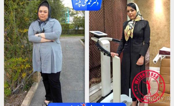 عکس های قبل و بعد لاغری ایرانی عکس های قبل و بعد لاغری ایرانی