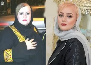 قبل و بعد لاغری مردان قبل و بعد لاغری مردان