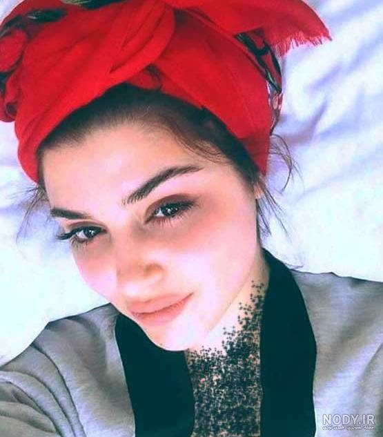 حاملگی غمزه ارچل حاملگی غمزه ارچل