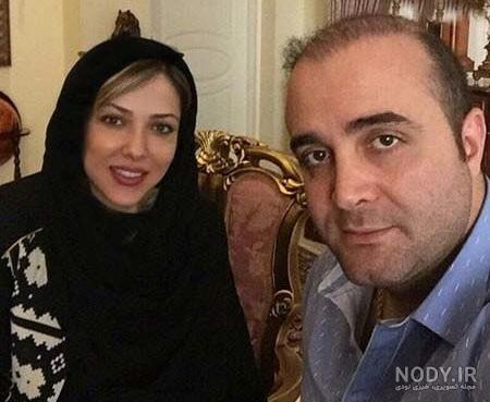 عکس سینا سرلک قبل از عمل بینی عکس سینا سرلک قبل از عمل بینی