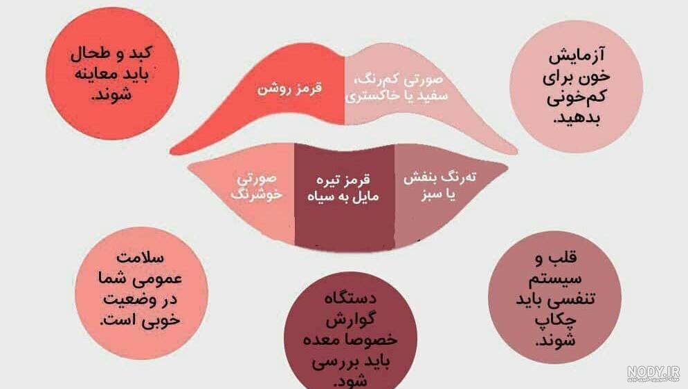 درمان کبودی لب درمان کبودی لب