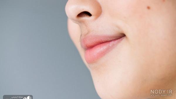 عکس کبودی دور لب نوزاد عکس کبودی دور لب نوزاد