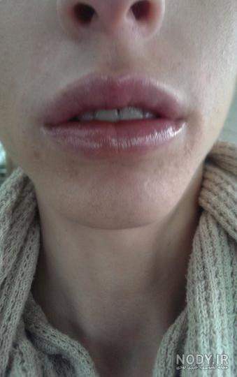 لب عکس کبودی گردن عاشقانه لب عکس کبودی گردن عاشقانه