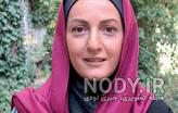 بوتاکس شقایق دهقان
