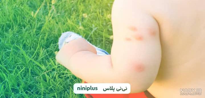 ساس از چی بوجود میاد