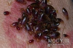 عکس بچه ی ساس