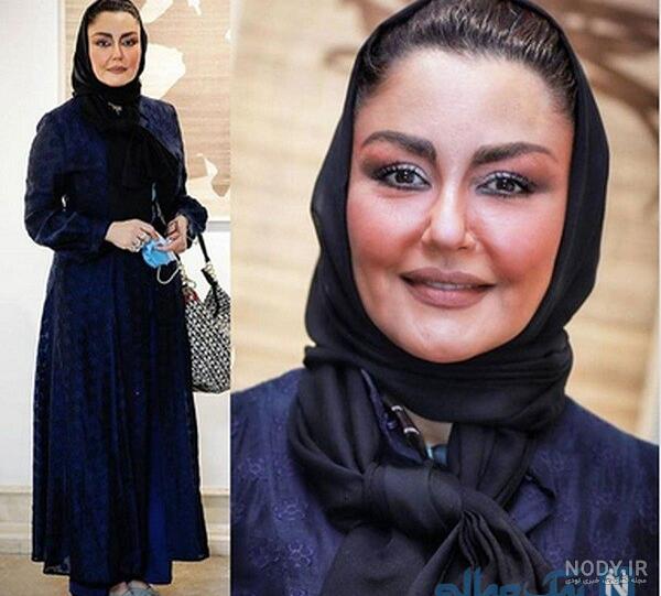 عکس جدید شقایق دهقان بعد از عمل بینی