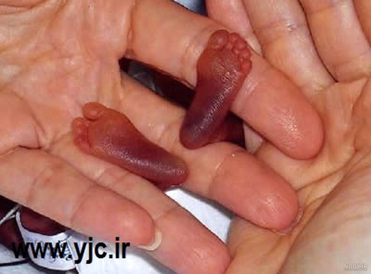 بچه های زشت و ترسناک