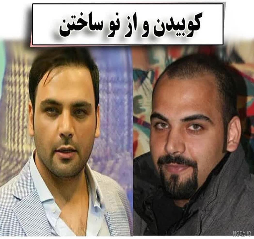 عکس احسان قبل از عمل