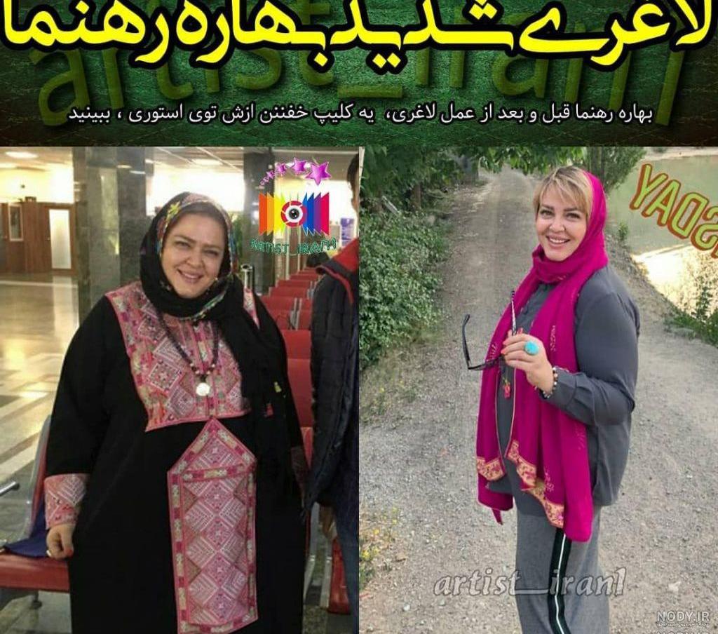 عکس بهاره رهنما قبل از عمل بینی عکس بهاره رهنما قبل از عمل بینی
