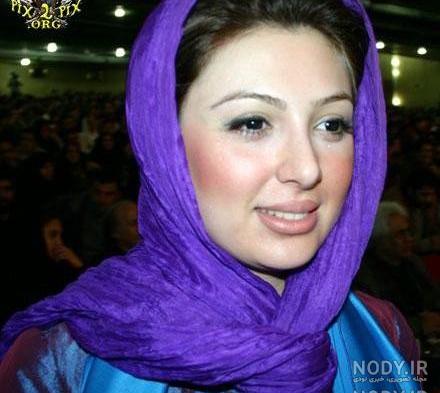 عکسهای بهاره رهنما قبل از عمل زیبایی عکسهای بهاره رهنما قبل از عمل زیبایی