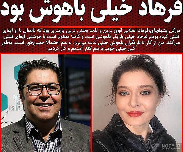 نورگل یشیلچای قبل از عمل بینی
