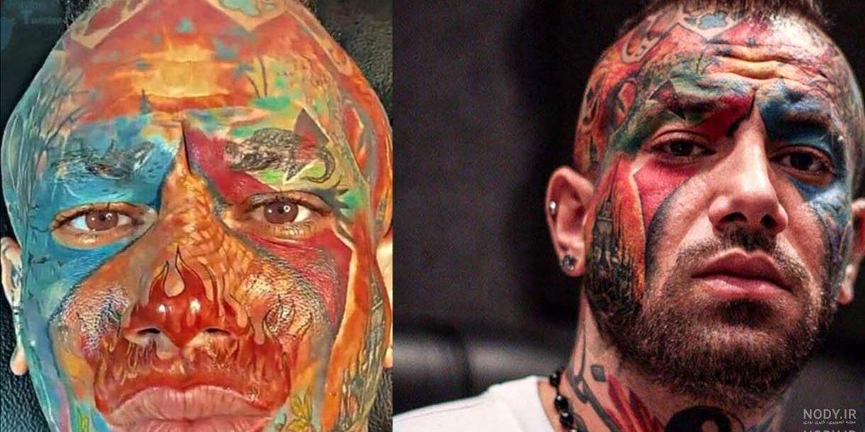 تتو داخل چشم