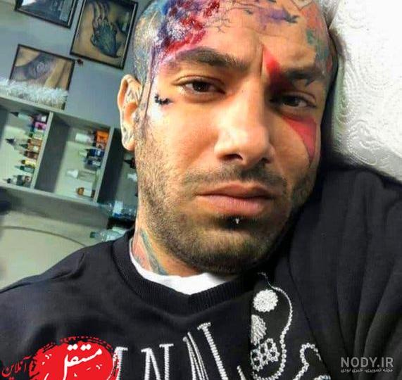 تتو داخل چشم