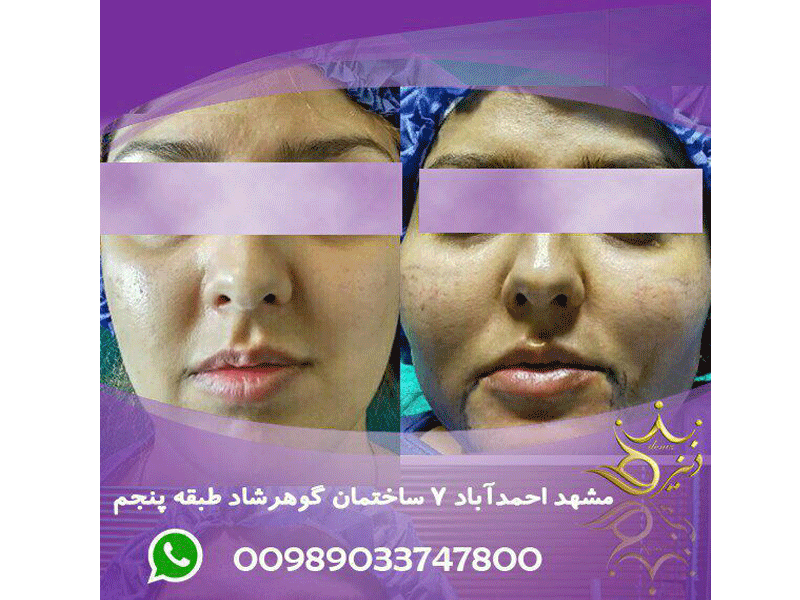 دنیز بایسال بدون ارایش دنیز بایسال بدون ارایش