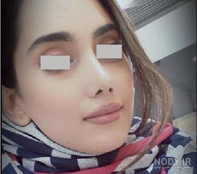 دکتر عالی پور دندانپزشک اهواز دکتر عالی پور دندانپزشک اهواز