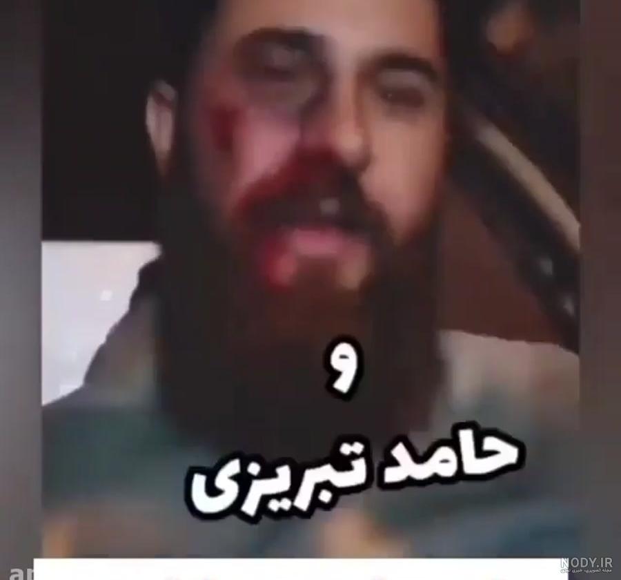 عکس حامد تبریزی و همسرش