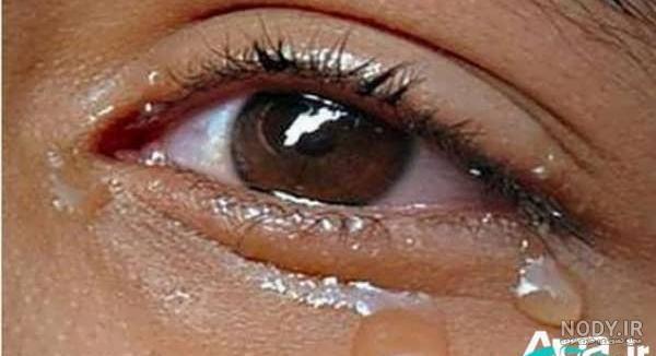 عکس چشم گریان با متن غمگین عکس چشم گریان با متن غمگین