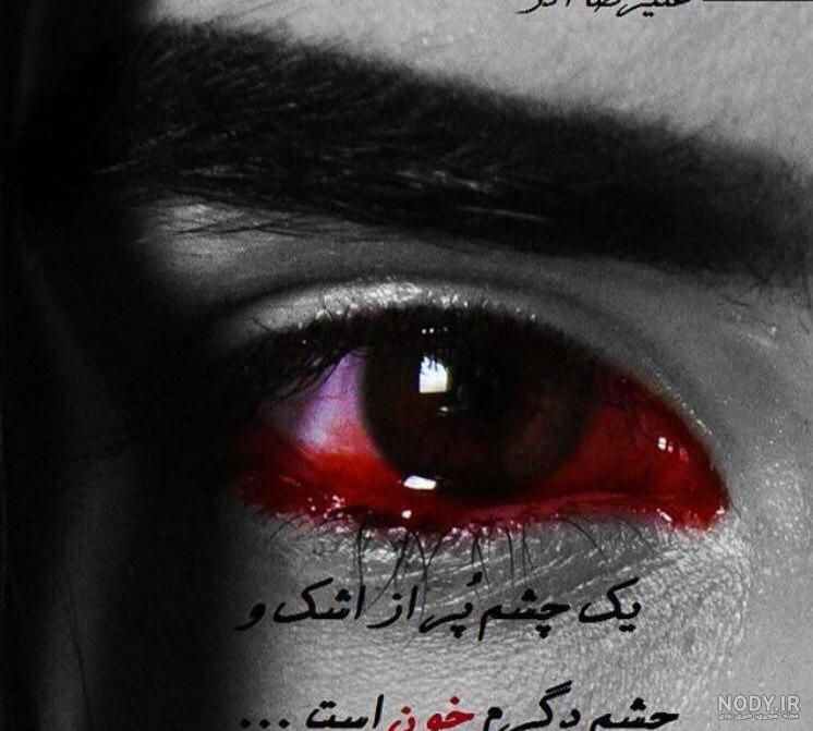 عکس چشم گریون پسر عکس چشم گریون پسر