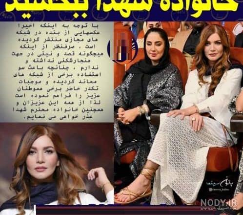 عکس نیکا فلاحی قبل از عمل عکس نیکا فلاحی قبل از عمل