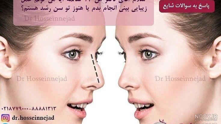 هزینه عمل بینی دکتر علی اصغر غفاری هزینه عمل بینی دکتر علی اصغر غفاری