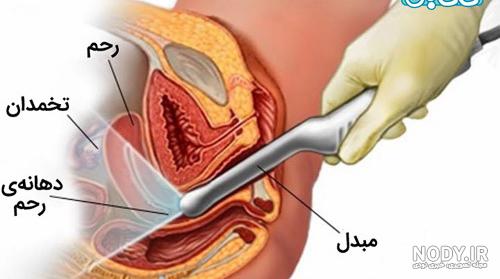آیا بچه خوره خطرناک است آیا بچه خوره خطرناک است