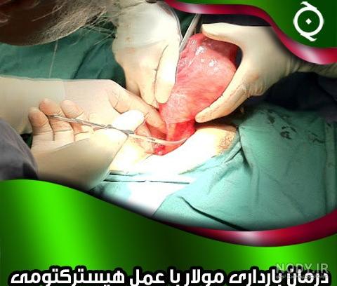 بچه خوره عکس بچه خوره عکس