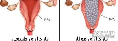 بچه خوره نی نی سایت بچه خوره نی نی سایت