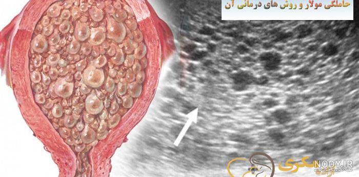 جواب پاتولوژی مولار جواب پاتولوژی مولار