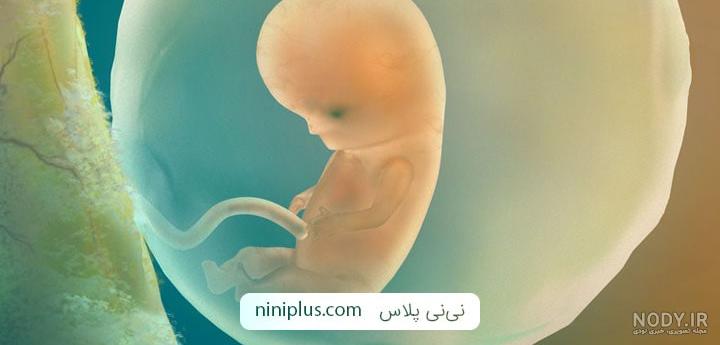 درمان مول در طب اسلامی درمان مول در طب اسلامی
