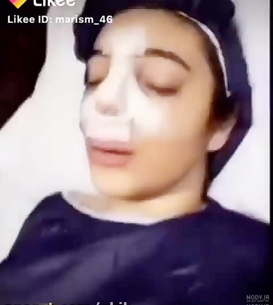 عکس طاها قبل از عمل