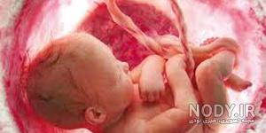 کیا بچه خوره داشتن کیا بچه خوره داشتن