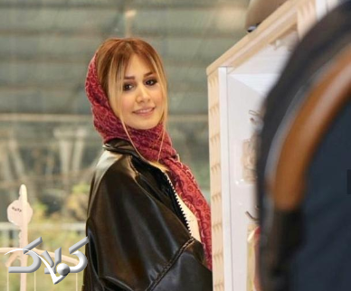 سپیده بزمی پور قبل از عمل زیبایی