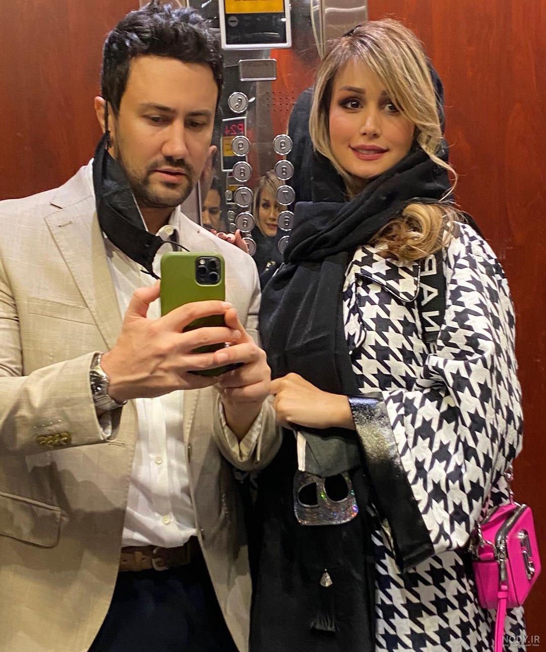 سپیده بزمی پور قبل از عمل زیبایی