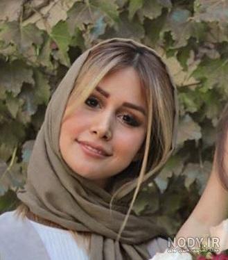عکس سپیده بزمی پور قبل از عمل زیبایی