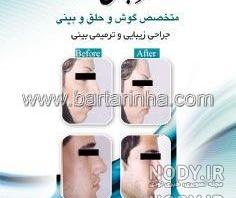 عکس جراحی بینی دکتر بهنام غفاری ساری