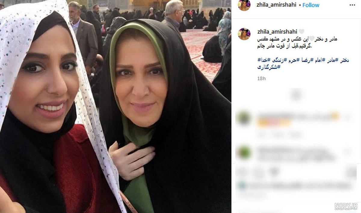 ژیلا امیرشاهی قبل از عمل