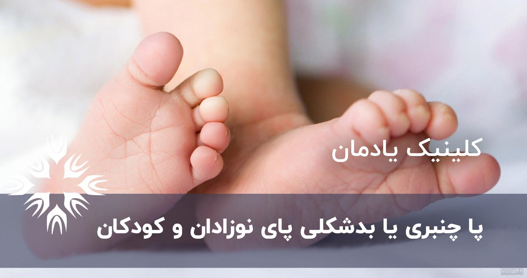 عکس نوزاد تازه متولد شده در بیمارستان عکس نوزاد تازه متولد شده در بیمارستان