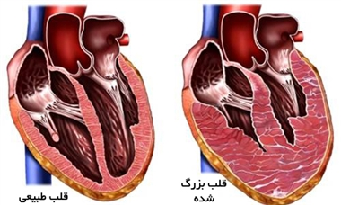 نقاشی قلب فانتزی